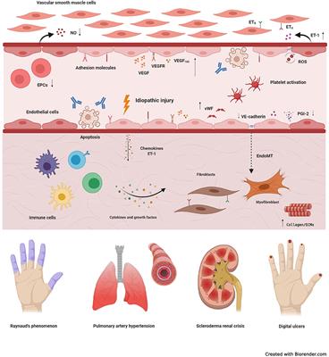 Management of Endothelial Dysfunction in Systemic Sclerosis: Current and Developing Strategies